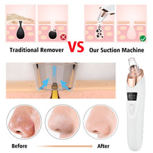 Load image into Gallery viewer, Electric Cleaning Blackhead Remover