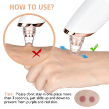 Load image into Gallery viewer, Electric Cleaning Blackhead Remover